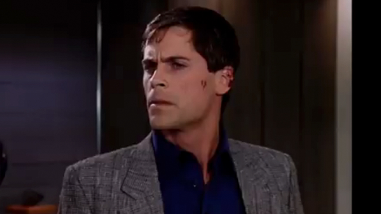 Rob Lowe with a bruise on his face in Tommy Boy