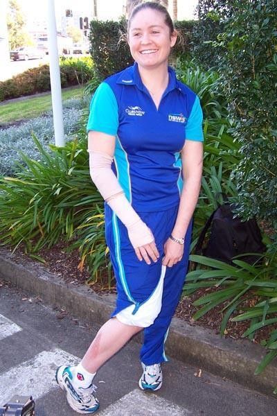 Kate Nichols managed a smile while showing off some of the abrasions she suffered in the crash.