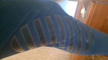 Left knee