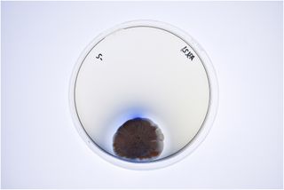 A petri dish containing the Streptomyces coelicolor