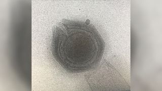Microscopic image of an open Tupanvirus particle