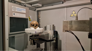 A human skull sits on a platform in front of a massive CT scanner