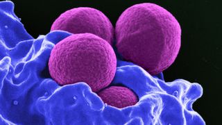 This colorized image (a scanning-electron micrograph) shows four spherical methicillin-resistant Staphylococcus aureus (MRSA) bacteria (purple) in the process of being “ingested” by a human neutrophil white blood cell (blue).