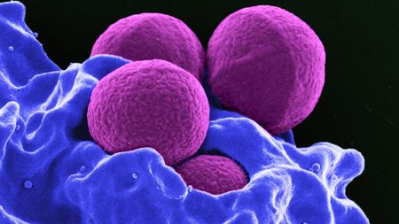 This colorized image (a scanning-electron micrograph) shows four spherical methicillin-resistant Staphylococcus aureus (MRSA) bacteria (purple) in the process of being &ldquo;ingested&rdquo; by a human neutrophil white blood cell (blue).