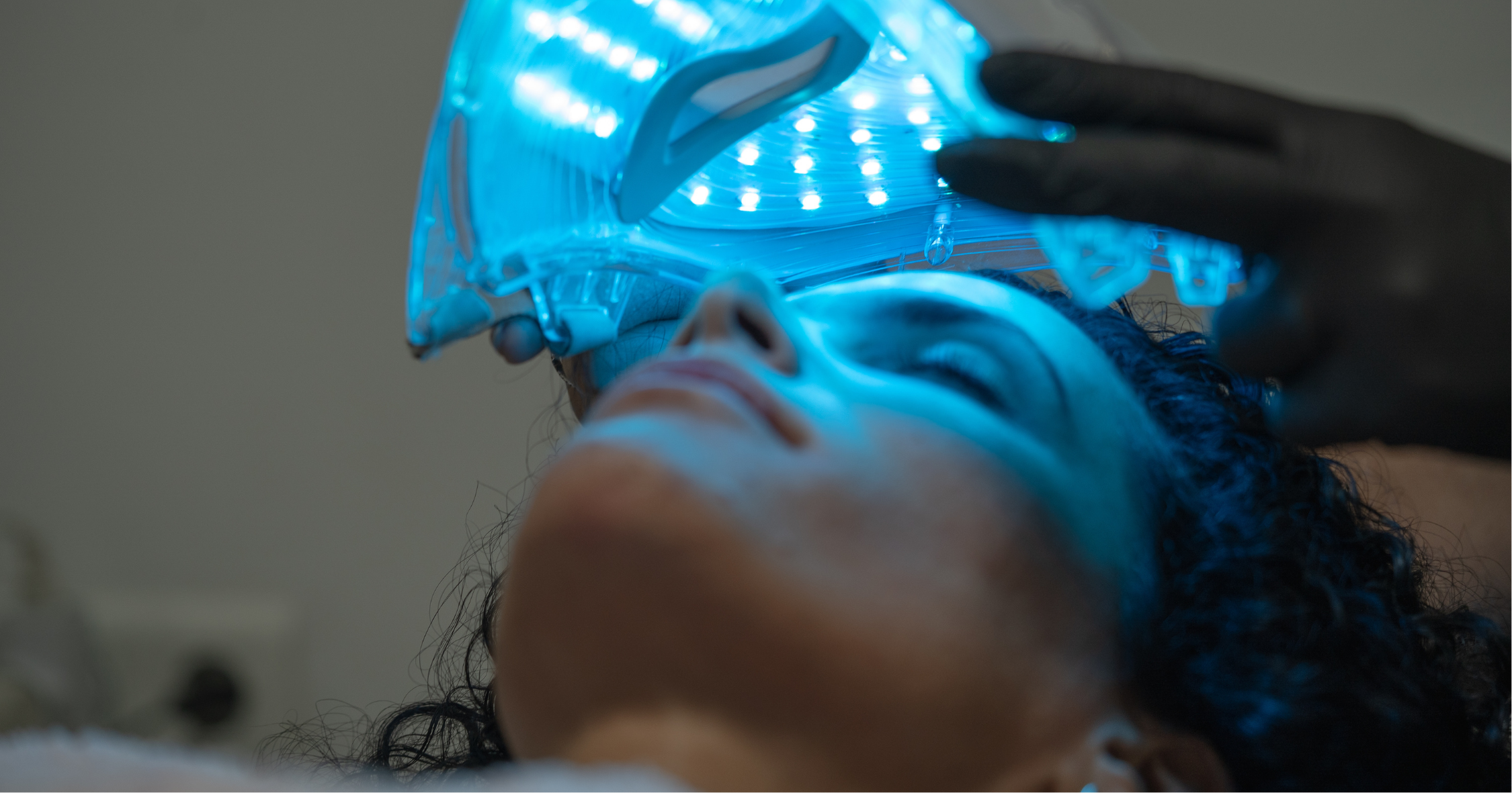 Blue Light LED Masks Can Cause Pigmentation