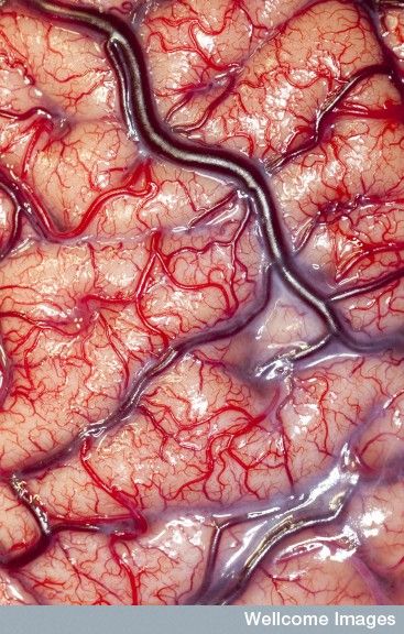 A photo of a living brain.