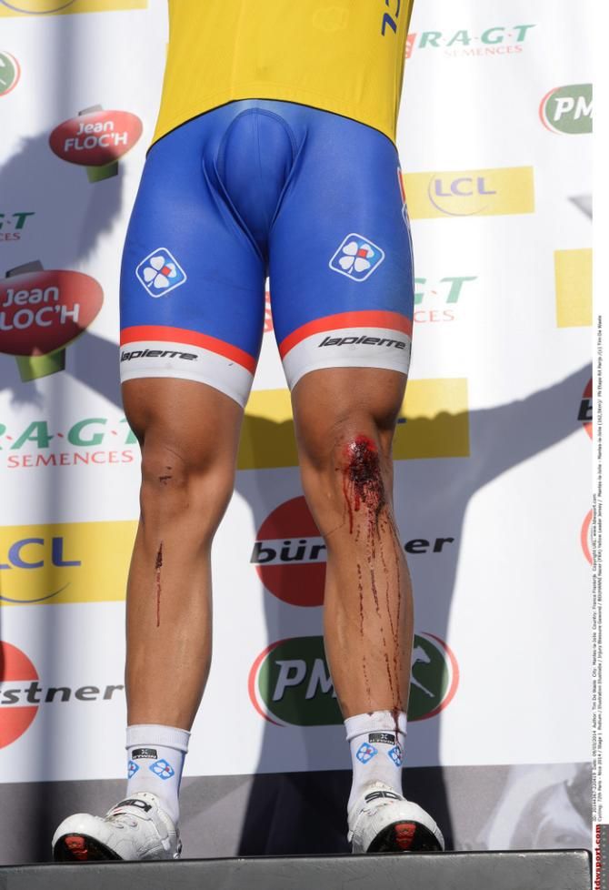 Nacer Bouhanni