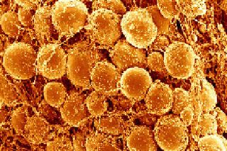 Fat cells such as these listen for incoming signals like FGF21, which tells them to burn more fat.