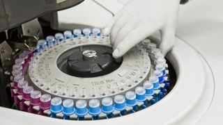 A gloved hand pulls test tubes out of a centrifuge