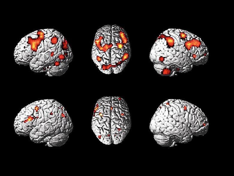 Искусственный мозг. Нейрон мозга прикольные картинки. Brain pattern. The Ultimate Brain.