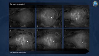 A still of six black-and-white microscope images of blood vessels in the skull of a mouse. Three images are shown on the top row and another three below. The background is navy blue.