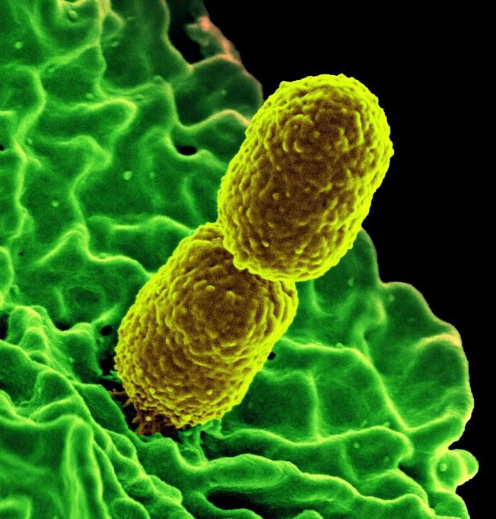 This image shows two carbapenem-resistant Klebsiella pneumoniae (CRKP) bacteria interacting with human white blood cells.