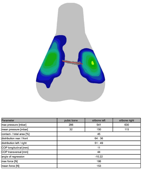A visual output of saddle pressure mapping