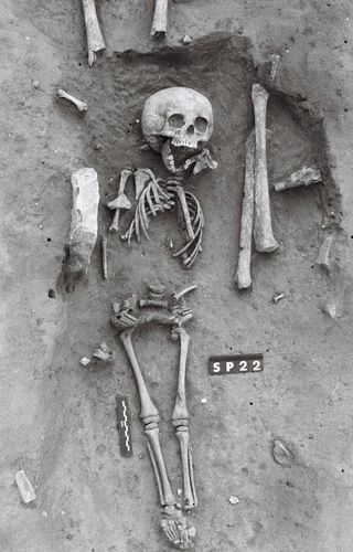 skeleton of child from medieval france who may have had Down syndrome.