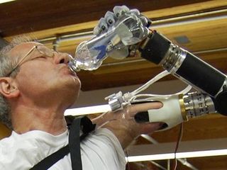 Shoe-controlled bionic arm