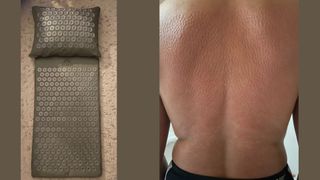 Minreet Kaur's acupressure mat next to view of her back after using the mat with clear pinpricks in the skin