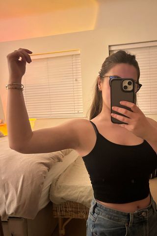 Tori after arm Airsculpt