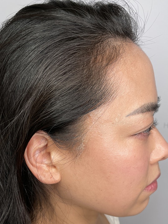 Harklinikken Hair Gain Extract Vorher und Nachher