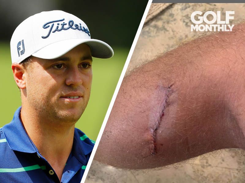 Justin Thomas Reveals Details Of Melanoma Scare