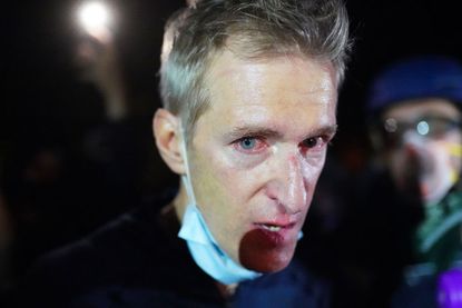 Portland Mayor Ted Wheeler reacts after being exposed to tear gas fired by federal officers while attending a protest against police brutality and racial injustice in front of the Mark O. Hat