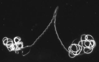 These are paired sperm of the diving beetle, Thermonectus marmoratus. The darkfield microscopy image shows both heads and tails of the paired sperm, which is 0.25 mm long!