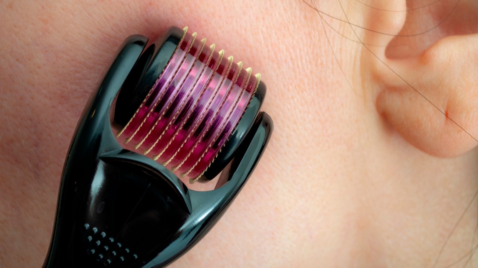 A person using a microneedling tool on her cheek