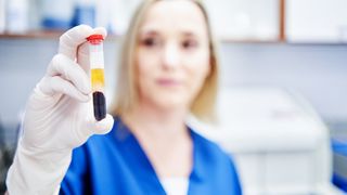 A woman is shown holding up a test tube containing a sample of blood. The different components of the blood have been separated, including the plasma which is visible in yellow. The test tube and the woman's hand are in focus, but the rest of the image is slightly blurred. 