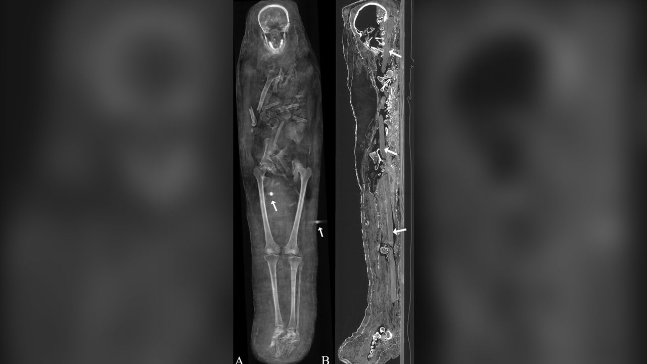Two metal objects (A) in the male mummy could be seals from the mummification workshop; The arrows (B) point to where the wooden board broke.