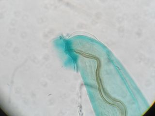 An image of Angiostrongylus cantonensis, the parasite that causes rat lungworm.