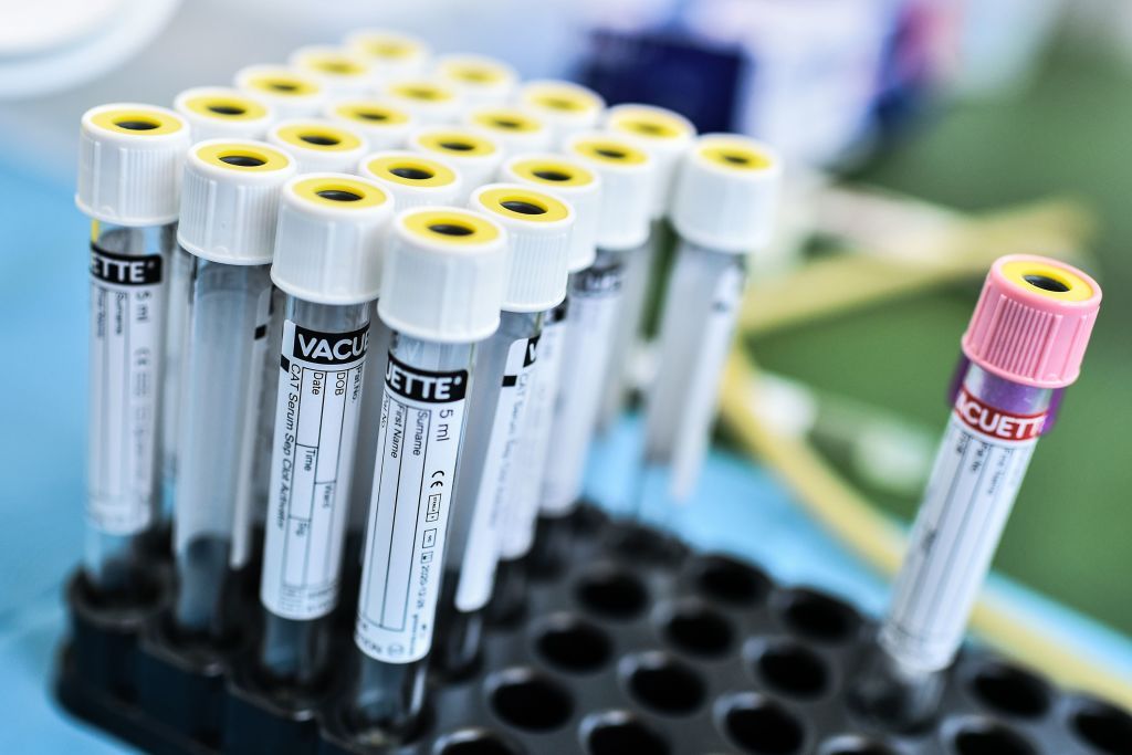 Coronavirus tests.