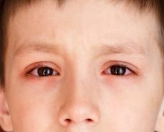 Boy with pink eye