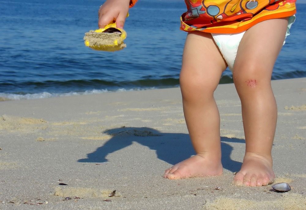 Kid playing on the beach with a scraped knee in Niteroi, Rio de Janeiro, Brazil.