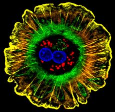 a hepatocyte, a common liver cell
