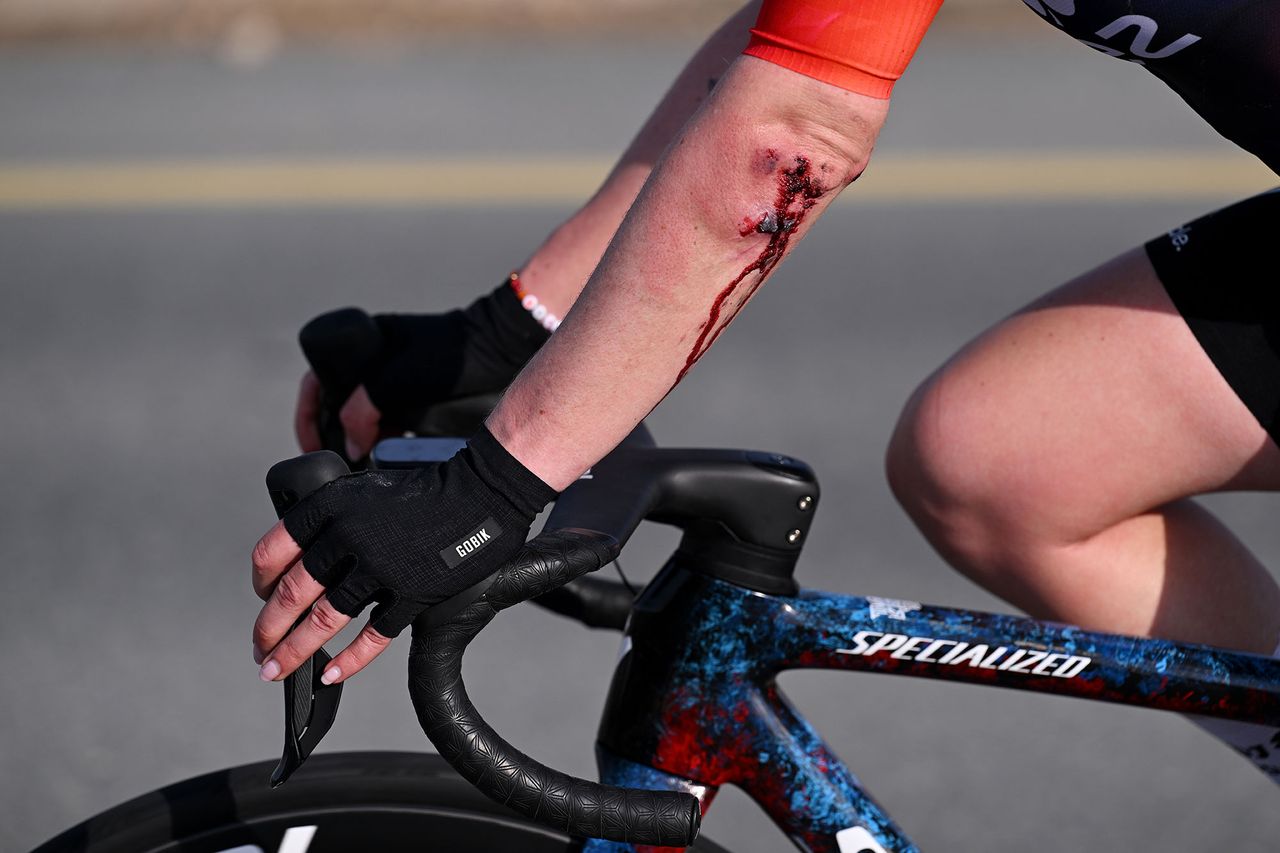 Coralie Demay left with a bloodied elbow after the high speed crash in the bunch