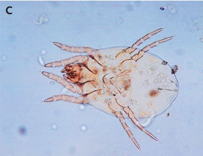 This photo shows a female mite of the species Dermatophagoides pteronyssinus.