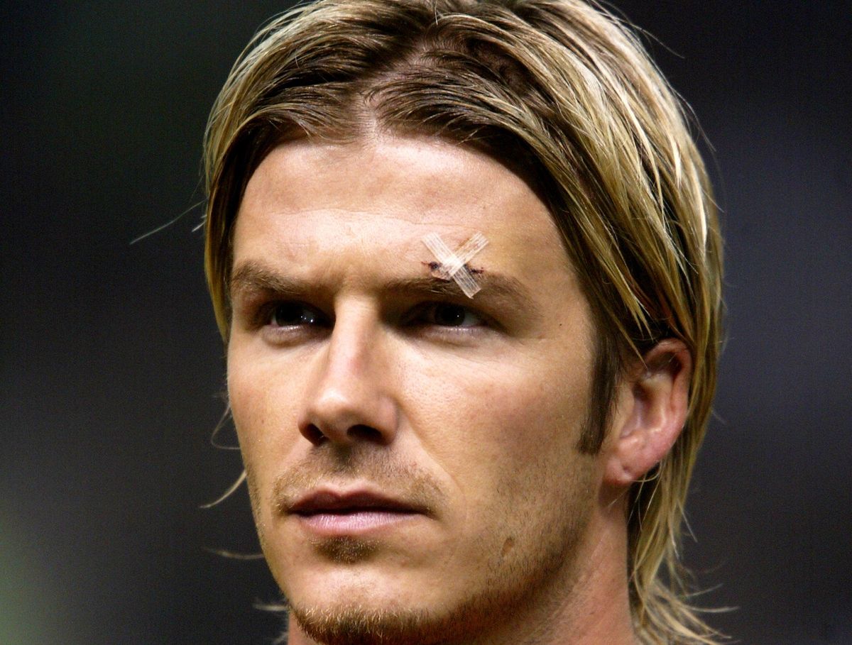 A shot of David Beckham's face, with Steri-Strips over a cut above his left eyebrow, sustained by being struck with a boot kicked by Manchester United manager Sir Alex Ferguson in the dressing room, February 2003