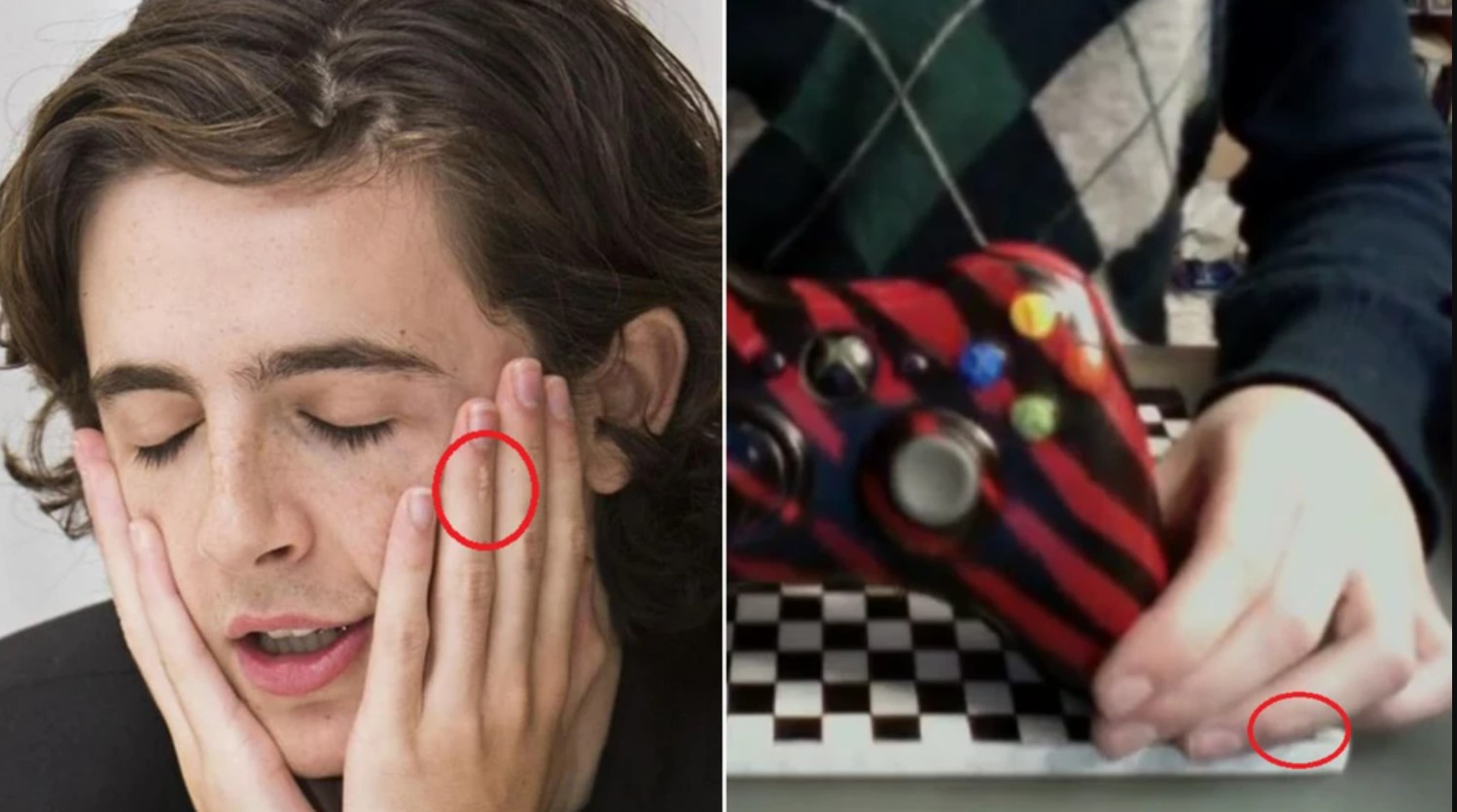 A comparison between the scar on Chalamet's finger and the finger in the video.