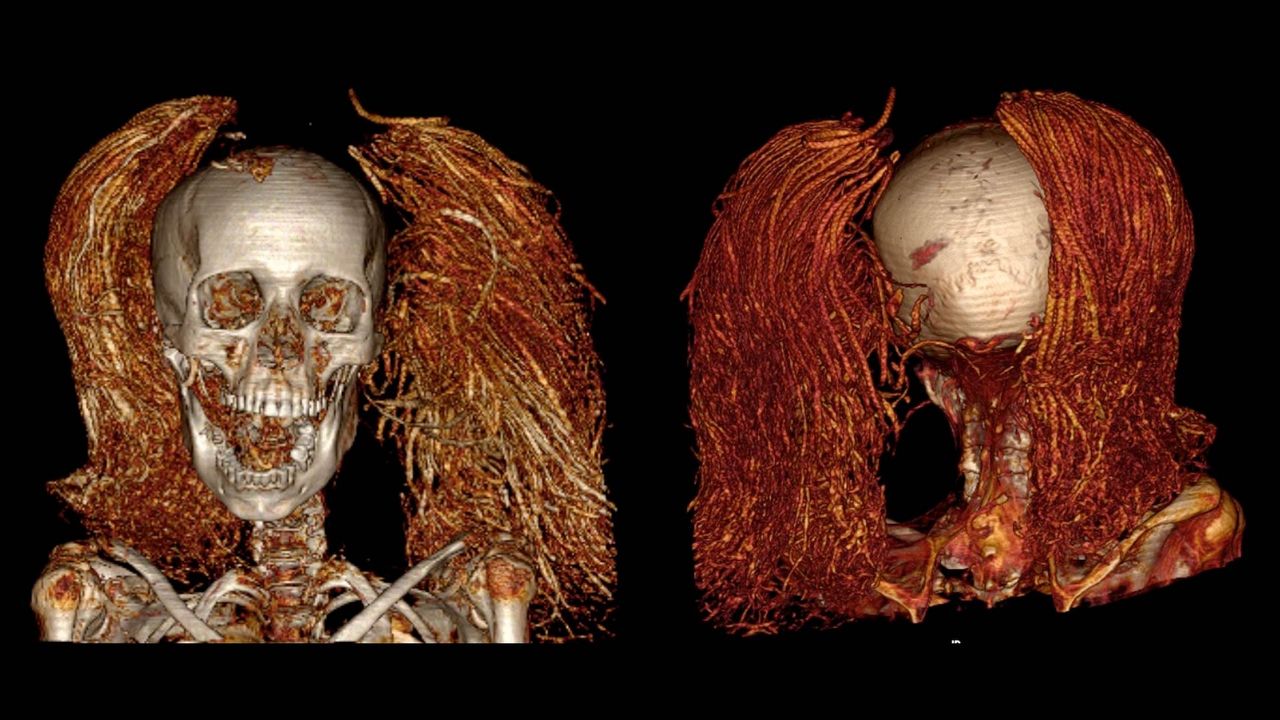 CT Scan of the screaming woman mummy head