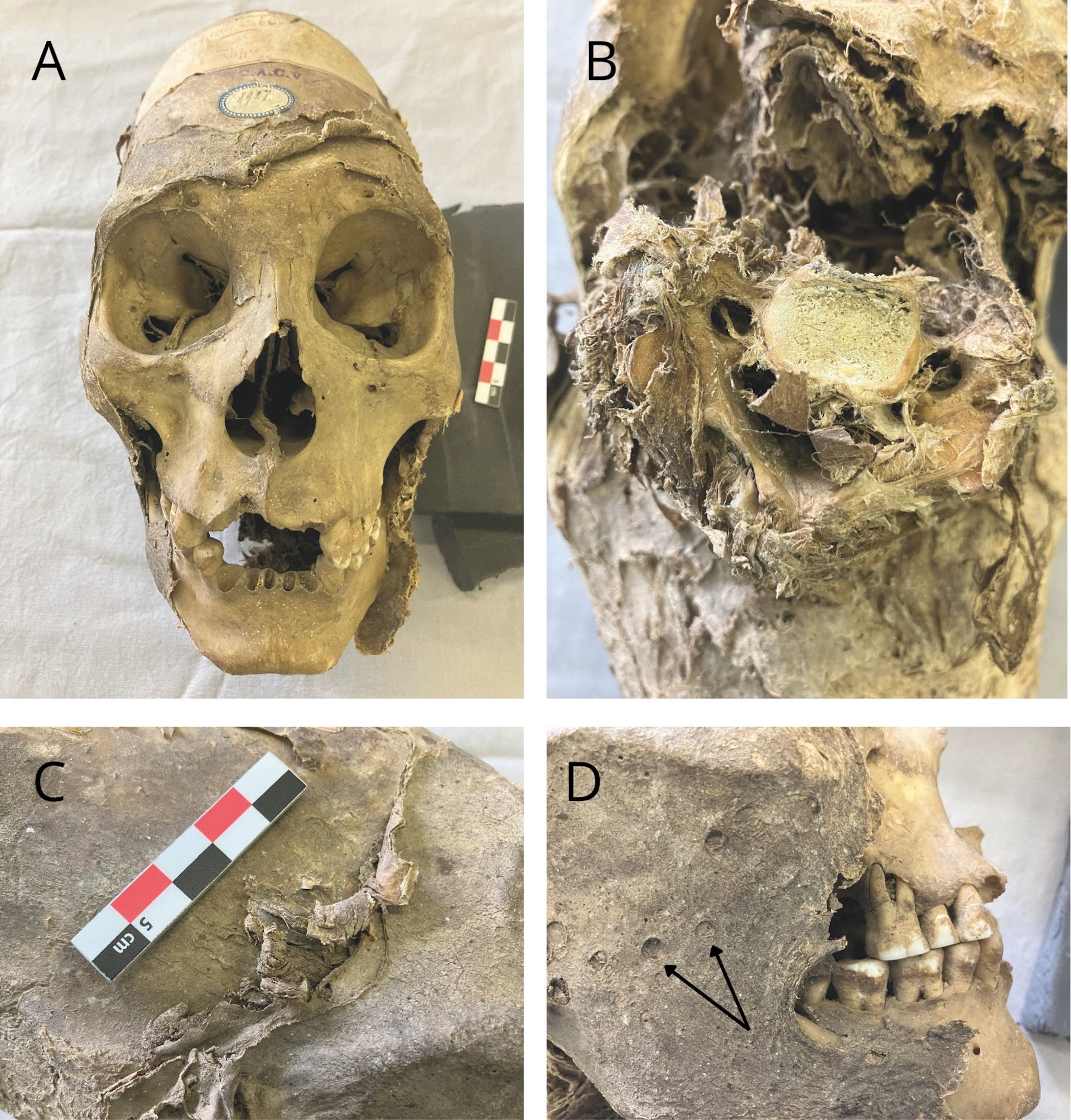 four different detailed angles of the mummified skull