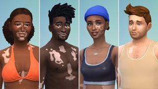 Various characters with vitiligo 