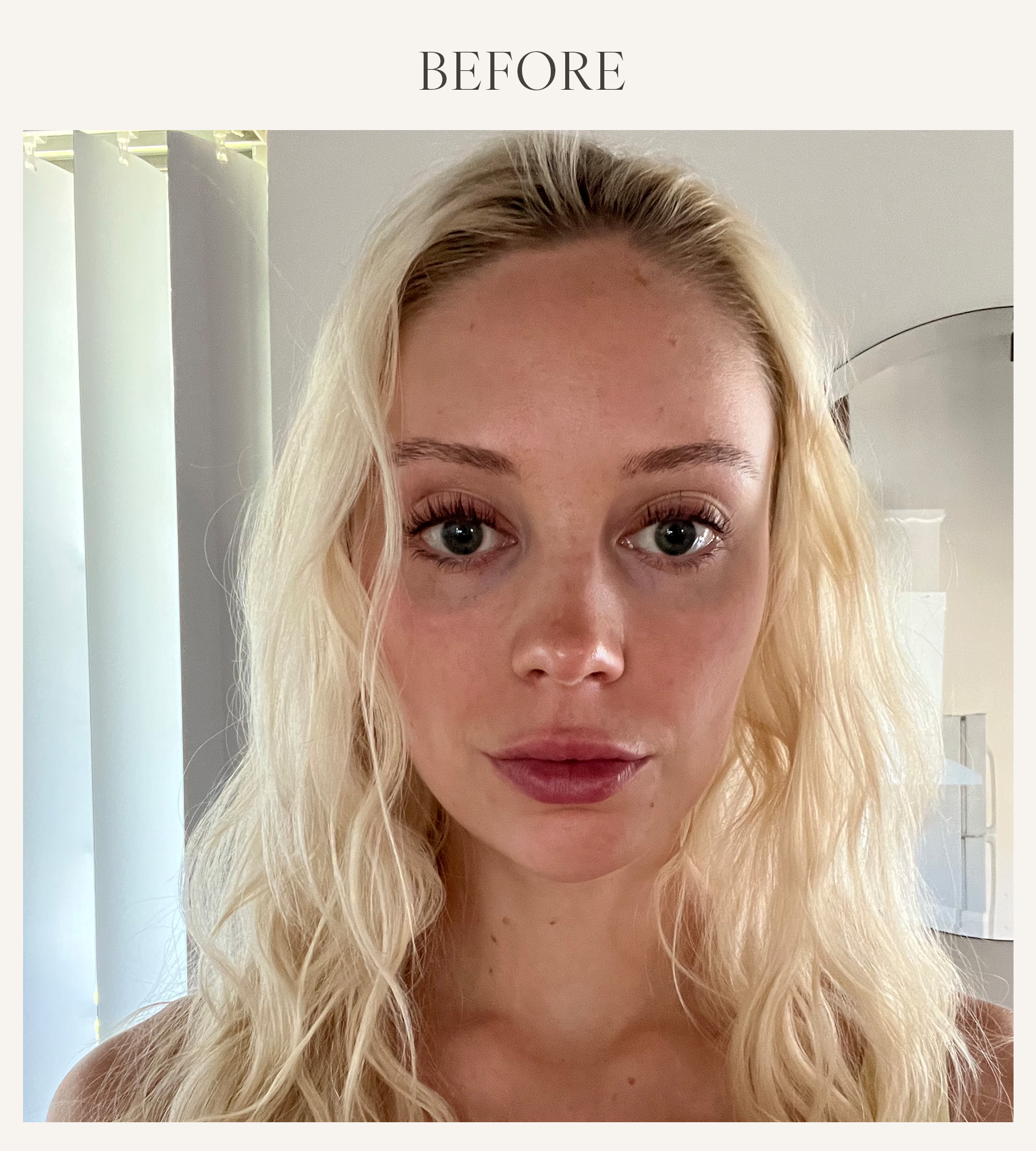 Before photo of Erin Jahns testing the KNC lip plumping mask