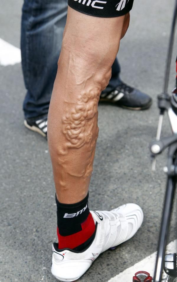 Georgie hincapie's legs after riding 15 editions of the Tour de France