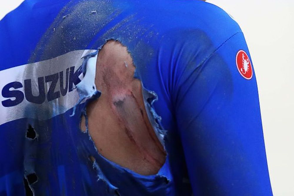 Martina Fidanza of Italy shows the damage from a fall in the Women's scratch 10k on day one of the UCI Track Cycling World Championships