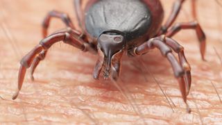 How to remove a tick