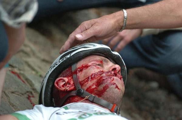 Jimmy Casper suffered facial lacerations