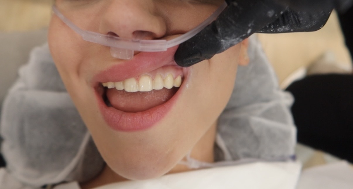 an image of the bottom half of a womans face with her top teeth showing and gums