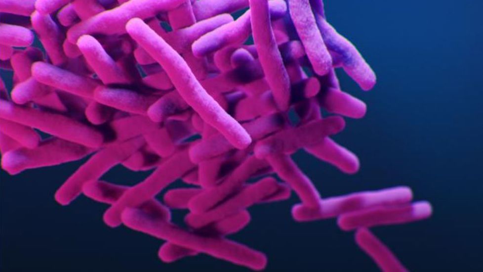 A medical illustration of drug-resistant Mycobacterium tuberculosis bacteria.