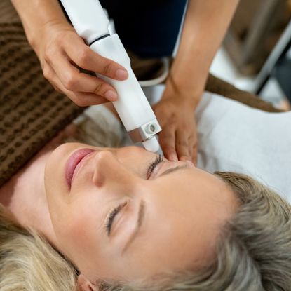 woman getting laser treatment for acne scar