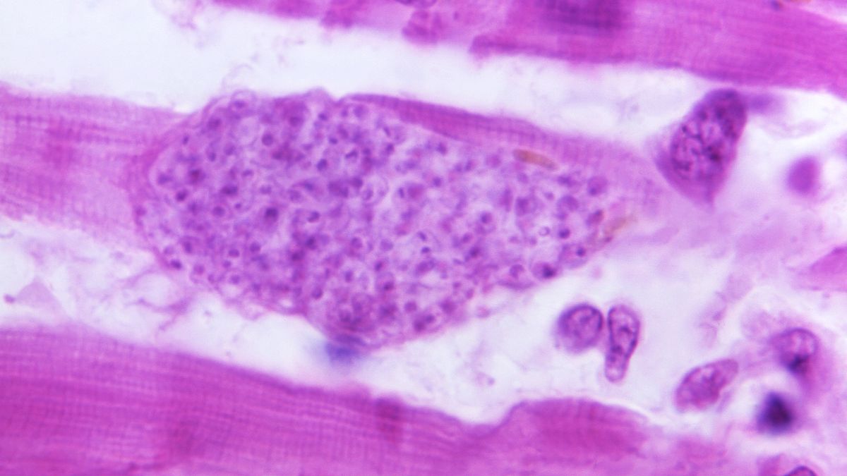Heart-warming? More like heart-harming. Here are 5 cardiac parasites   for Valentine's Day