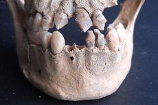 Skull fragment from 17th-century slave